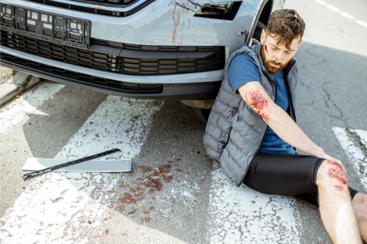 Severe Injuries Pedestrians Suffer in Commercial Vehicle Accidents