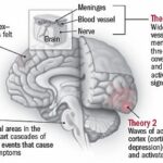 When Migraines Signal Something Serious: What to Watch For