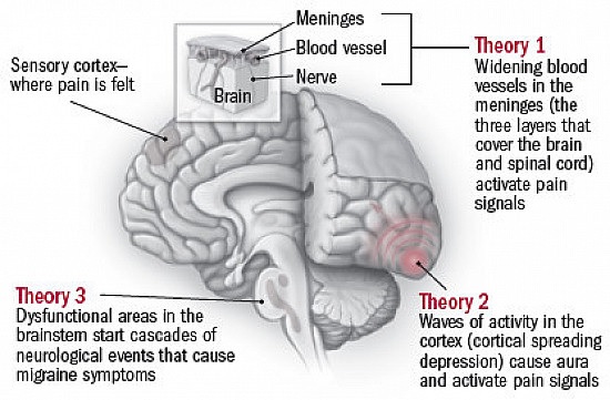 When Migraines Signal Something Serious: What to Watch For